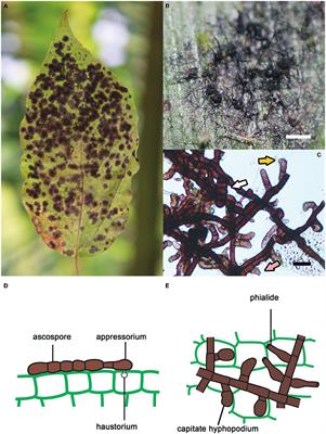Hyperparasitic Fungi on Black Mildews (Meliolales, Ascomycota): Hidden Fungal Diversity in the Tropics